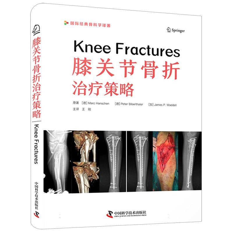 膝关节骨折治疗策略