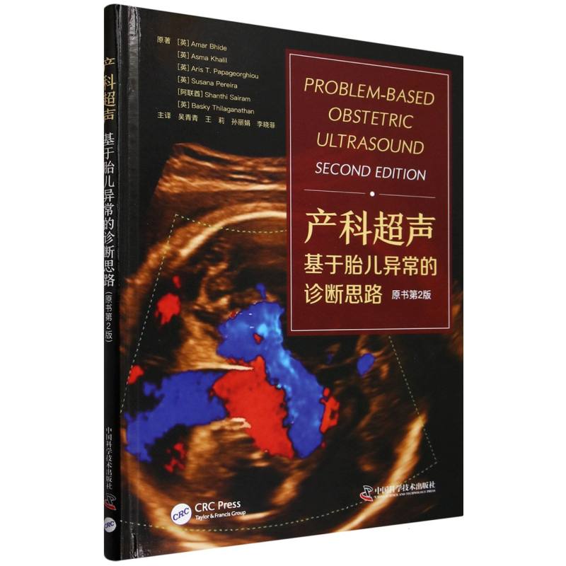 产科超声