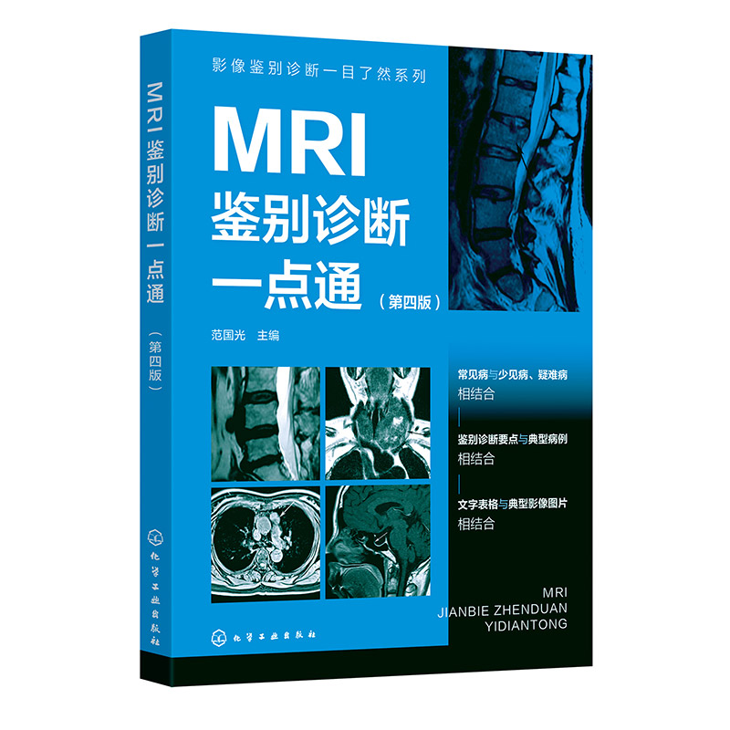 影像鉴别诊断一目了然系列--MRI鉴别诊断一点通（第四版）...