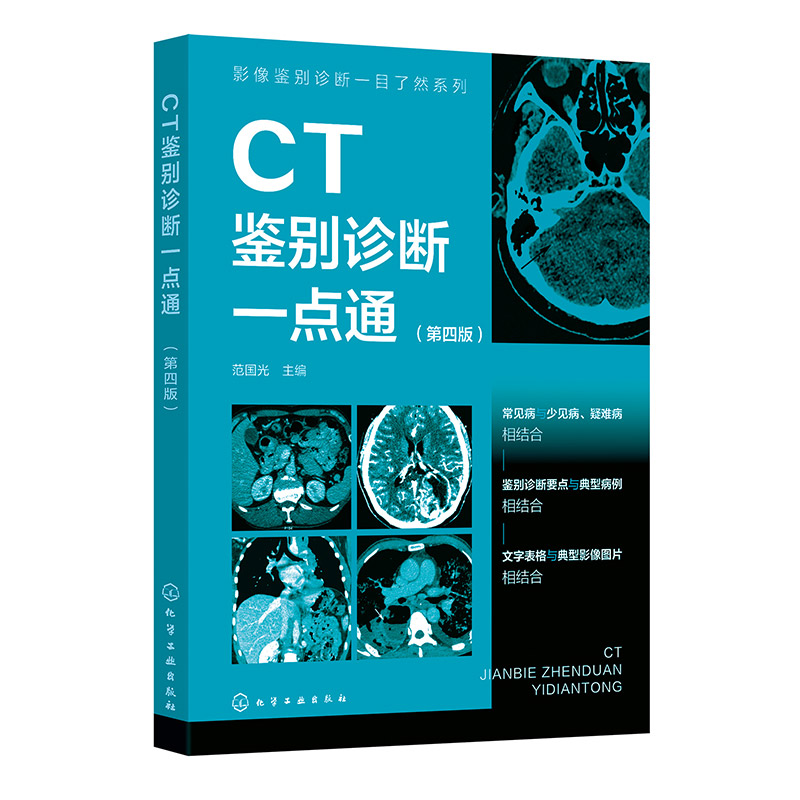 影像鉴别诊断一目了然系列--CT鉴别诊断一点通（第四版）...