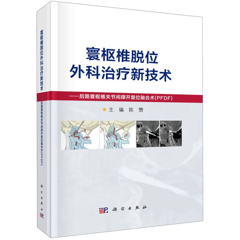 寰枢椎脱位外科治疗新技术--后路寰枢椎关节间撑开复位融合术(PFDF)